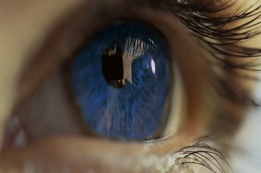 ИИ научили анализировать сосуды глаза для предупреждения инсульта