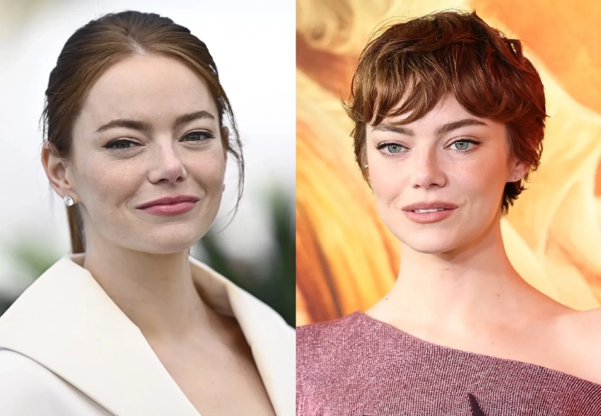 Эмму Стоун заподозрили в пластике